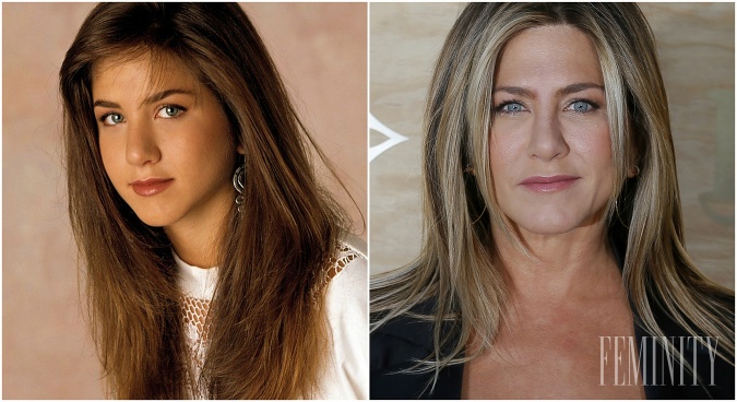 Takto vyzerala Jennifer Aniston pred a po úprave nosa, ktorú podstúpila až dvakrát. 