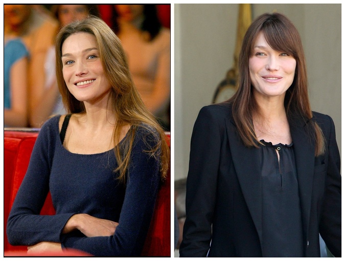 Carla Bruni je milovníčka botoxu.