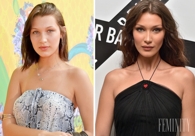 Bella Hadid čelí často kritike kvôli nepriznaným plastickým operáciám