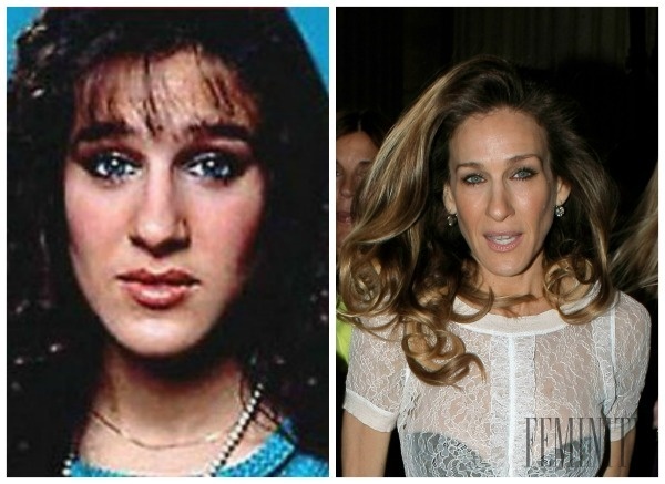 Sarah Jessica Parker podstúpila taktiež estetické zákroky, viď fotografia pred a po