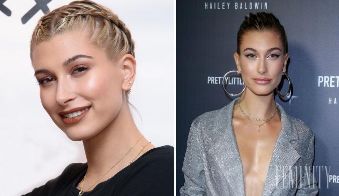 Hailey Bieber si tiež prešla úpravami vzhľadu