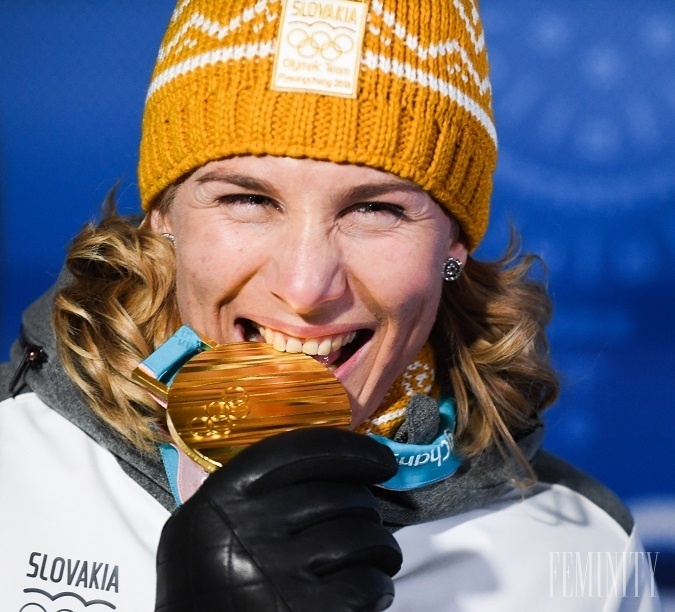 Anastasia Kuzminova si dokonca takto vtipne overila pravosť svojho zlata