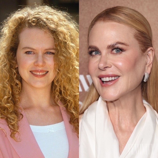 Nicole Kidman sa zmenila úplne