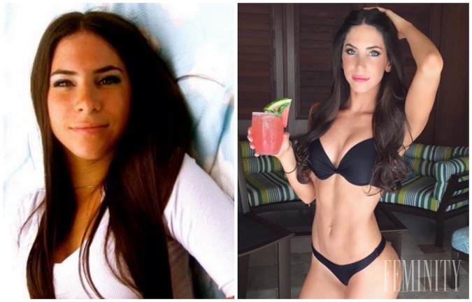 Instagramová kráska jen Selter je známa najmä vďaka svojmu dokonalému pozadiu. Plastiky však neskryje 