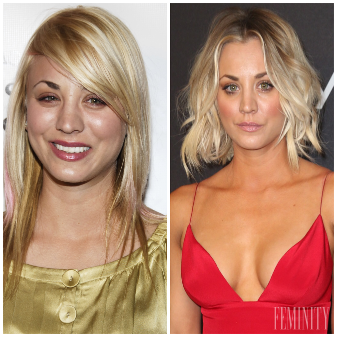 Hviezda seriálu Teória veľkého tresku, Kaley Cuoco, si tiež ľahla pod nôž