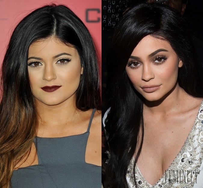 Snáď žiadna iná hviezda tak nepotvrdzuje ani neodmieta obvinenia z plastických operácií ako práve mladučká, ale podnikavá Kylie Jenner 